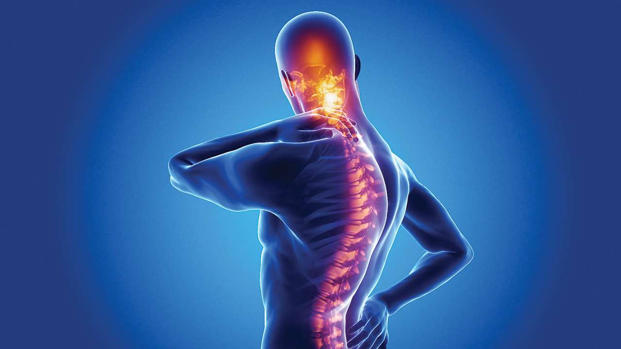 Spondylitis